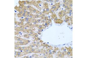 Immunohistochemistry of paraffin-embedded human liver using CCM2 antibody at dilution of 1:100 (x40 lens). (CCM2 antibody)