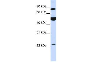 WB Suggested Anti-GCS1 Antibody Titration:  0. (GCS1 antibody  (N-Term))