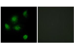 Immunofluorescence analysis of HeLa cells, using SIN3B antibody. (SIN3B antibody  (Internal Region))