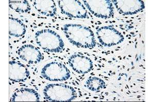 Image no. 11 for anti-Checkpoint Kinase 2 (CHEK2) antibody (ABIN1497496)