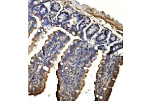 IHC analysis of CPS1 using anti-CPS1 antibody (ABIN7599871).