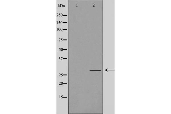 LRAT antibody  (Internal Region)