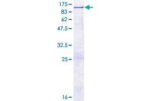 OS9 Protein (AA 1-612) (GST tag)