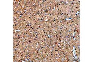 IHC analysis of SEC22B using anti-SEC22B antibody (ABIN7602121). (SEC22B antibody  (AA 6-197))