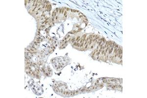 Immunohistochemistry of paraffin-embedded rat ovary using LGR5/GPR49 Rabbit pAb  at dilution of 1:300 (40x lens). (LGR5 antibody  (AA 824-907))