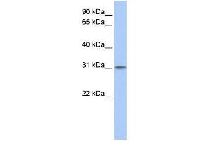 WB Suggested Anti-ODF3L1 Antibody Titration: 0. (ODF3L1 antibody  (N-Term))