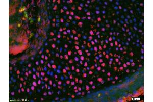 Immunofluorescence (IF) image for anti-Myocyte Enhancer Factor 2A (MEF2A) (pSer408) antibody (ABIN743783)