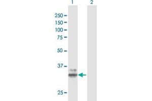 Western Blot analysis of PPT1 expression in transfected 293T cell line by PPT1 MaxPab polyclonal antibody. (PPT1 antibody  (AA 1-306))
