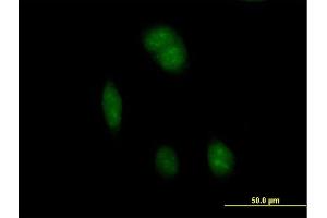 Immunofluorescence of purified MaxPab antibody to FTSJ1 on HeLa cell.
