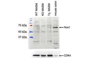 AP31401PU-N NOX1 antibody staining of MASM lysate at 1 µg/ml (35 µg protein in RIPA buffer). (NOX1 antibody  (Internal Region))