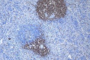 IHC analysis of CD3 epsilon/Cd3e using anti-CD3 epsilon/Cd3e antibody (ABIN7600665). (CD3 epsilon antibody  (AA 22-113))