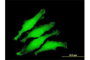 Immunofluorescence of purified MaxPab antibody to ZNF397 on HeLa cell. (ZNF397 antibody  (AA 1-275))