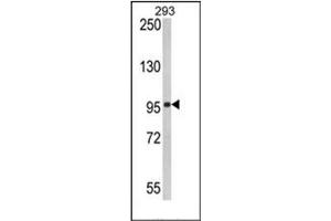 Image no. 1 for anti-DEAD (Asp-Glu-Ala-Asp) Box Polypeptide 58 (DDX58) (AA 592-622) antibody (ABIN357195) (DDX58 antibody  (AA 592-622))