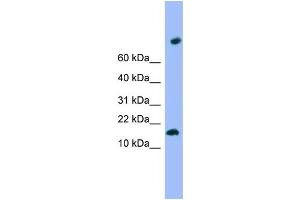 WB Suggested Anti-TMEM42 Antibody Titration: 0. (TMEM42 antibody  (N-Term))
