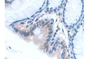 Immunohistochemistry (IHC) image for anti-Synaptosomal-Associated Protein, 23kDa (SNAP23) (AA 1-210) antibody (ABIN7444226)