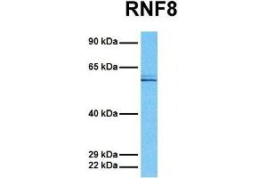 Host:  Rabbit  Target Name:  RNF8  Sample Tissue:  Human MCF7  Antibody Dilution:  1. (RNF8 antibody  (C-Term))
