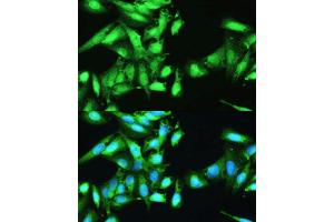 Immunofluorescence analysis of U2OS cells using STAT1 antibody. (STAT1 antibody  (AA 650-750))