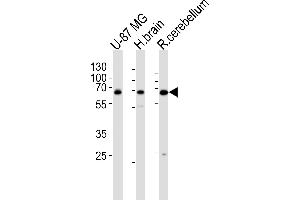Western blot analysis of lysates from U-87 MG cell line , human brain and rat cerebellum tissue lysate(from left to right), using Mouse Camkk2 Antibody at 1:1000 at each lane. (CAMKK2 antibody  (N-Term))