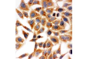 Anti-HSD17B1 antibody, ICC: HELA Cell