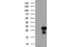 Western Blotting (WB) image for anti-Regulator of G-Protein Signaling 16 (RGS16) antibody (ABIN1500691) (RGS16 antibody)