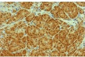 Image no. 3 for anti-Transportin 1 (TNPO1) antibody (ABIN108619) (Transportin 1 antibody)