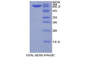 SDS-PAGE (SDS) image for Klotho (KL) (AA 517-956) protein (His tag) (ABIN2123130)
