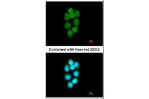 ICC/IF Image Immunofluorescence analysis of methanol-fixed A431, using TDP1, antibody at 1:200 dilution. (TDP1 antibody)