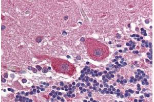Human Brain, Cerebellum: Formalin-Fixed, Paraffin-Embedded (FFPE) (Huntingtin antibody  (AA 2703-2911))