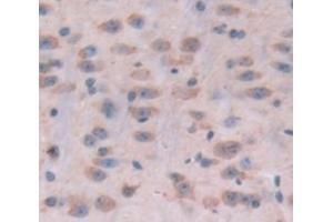 Used in DAB staining on fromalin fixed paraffin- embedded Kidney tissue (POMT1 antibody  (AA 318-513))