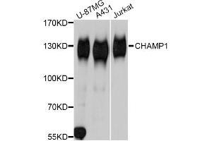 Western blot analysis of extracts of various cell lines, using CHAMP1 Antibody. (ZNF828 antibody)