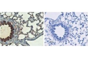 Expression of CFTR in rat lungs - Immunohistochemical staining of rat lungs sections using Anti-CFTR Antibody (ABIN7043096, ABIN7044127 and ABIN7044128) (left panel).