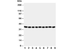 Western blot testing of Kallikrein 10 antibody and Lane 1:  rat ovary;  2: rat testis;  3: rat spleen;  4: rat liver;  5: 22RV;  6: SROV;  7: HeLa;  8: MCF-7;  9: MM231 cell lysate (Kallikrein 10 antibody  (C-Term))