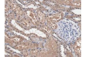 DAB staining on IHC-P; Samples: Human Kidney Tissue (DICER1 antibody  (AA 6-290))