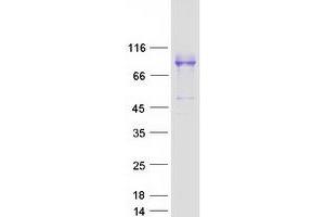 Validation with Western Blot