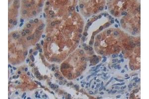 Detection of Cys-C in Human Kidney Tissue using Polyclonal Antibody to Cystatin C (Cys-C) (Cystathionine-gamma-Synthase Precursor (CYS) (AA 27-146) antibody)