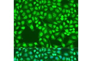 Immunofluorescence analysis of U2OS cells using Defb26 Polyclonal Antibody at dilution of 1:100. (DEFB126 antibody)