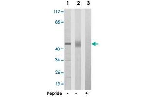 Western blot analysis of extracts from 293 cells (Lane 1) and mouse liver cells (Lane 2 and lane 3), using ACVR1B polyclonal antibody . (Activin A Receptor Type IB/ALK-4 antibody  (AA 73-122))