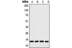 Western blot analysis of UBC9 expression in HeLa (A), A431 (B), Raw264. (UBE2I antibody  (C-Term))
