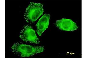 Immunofluorescence (IF) image for anti-Inhibitor of kappa Light Polypeptide Gene Enhancer in B-Cells, Kinase gamma (IKBKG) (AA 1-110) antibody (ABIN563665)