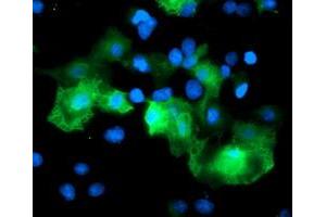 Anti-RFPL3 mouse monoclonal antibody (ABIN2455785) immunofluorescent staining of COS7 cells transiently transfected by pCMV6-ENTRY RFPL3 (RC206518). (RFPL3 antibody)