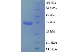 SDS-PAGE (SDS) image for Dynactin 3 (p22) (Dctn3) (AA 2-176) protein (His-SUMO Tag) (ABIN5709391)