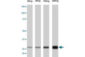 PRSS1 monoclonal antibody, clone A16-N  . (PRSS1 antibody  (N-Term))