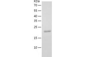 Western Blotting (WB) image for YKT6 V-SNARE Homolog (YKT6) (AA 1-198) protein (His tag) (ABIN7284388) (YKT6 Protein (AA 1-198) (His tag))