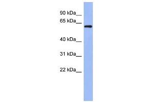 WB Suggested Anti-RBM47 Antibody Titration: 0. (RBM47 antibody  (Middle Region))