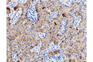 IHC analysis of PCK1/PEPC using anti-PCK1/PEPC antibody (ABIN7599502). (PCK1 antibody  (AA 1-622))