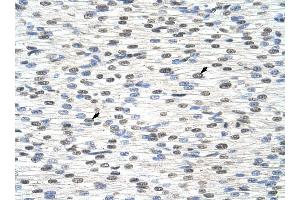 RBM28 antibody was used for immunohistochemistry at a concentration of 4-8 ug/ml to stain Myocardial cells (arrows) in Human Heart. (RBM28 antibody  (C-Term))