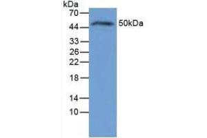 Figure. (IL-6 Receptor antibody  (AA 19-10))