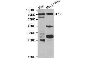 Western blot analysis of extracts of various cell lines, using F10 antibody (ABIN5970678) at 1/1000 dilution. (Coagulation Factor X antibody)