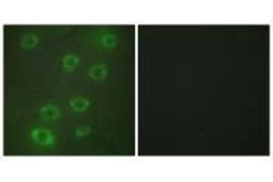 Immunofluorescence analysis of HUVEC cells, using PTX3 antibody. (PTX3 antibody  (N-Term))