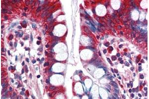 Human Small Intestine (formalin-fixed, paraffin-embedded) stained with ACSL5 antibody ABIN351483 at 2. (ACSL5 antibody  (AA 727-739))